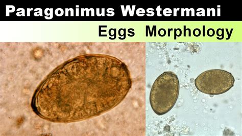 Paragonimus Westermani Eggs Morphology - YouTube