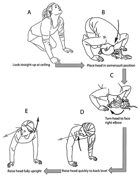 Epley maneuver instructions - how to do the Epley maneuver at home