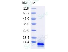 CXCL4/PF4 Protein Overview | Sino Biological