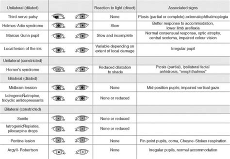 Irregular pupil shape - serrefootball