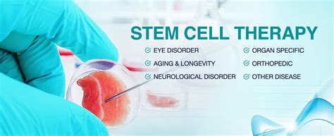 Stem Cell Therapy Hospital & Treatment Centre in Delhi India