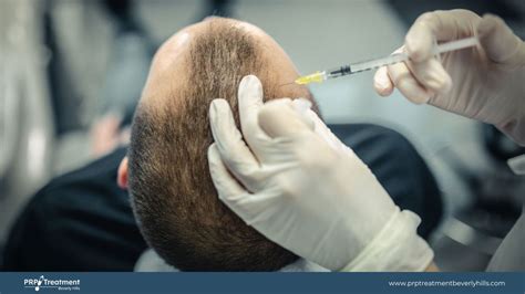 PRP Hair Treatment Side Effects | PRP Treatment