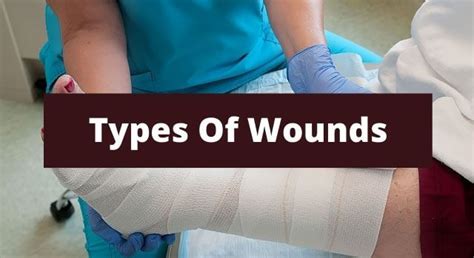 Different Types Of Wounds - Wound Care Surgeons