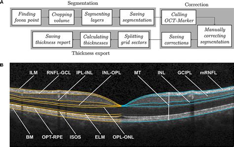 Retinal Layers Oct