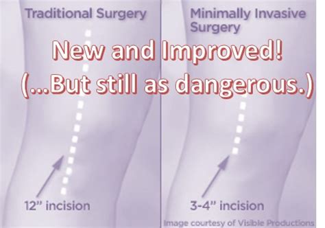 Is Minimally Invasive Knee Replacement Safer? Is a Big Surgery Safer than a Really Big Surgery ...