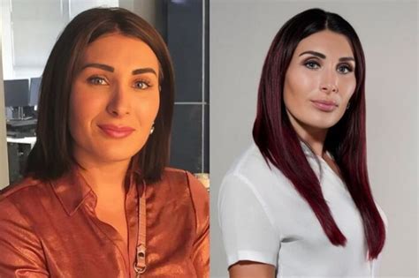 Laura Loomer Plastic Surgery: Before & After Snapshots Analyzed