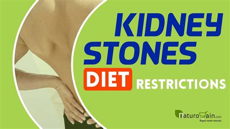 Kidney Stones Diet Restrictions to Pass Stone Painlessly at Home - YouTube