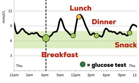 Benefits of a CGM (Libre or Dexcom G6) for Diabetes Control