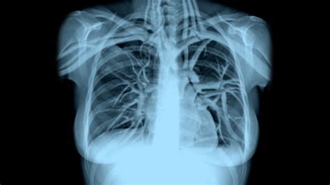 Female Chest Xray With Breathing And Heartbeat Stock Footage Video | Getty Images