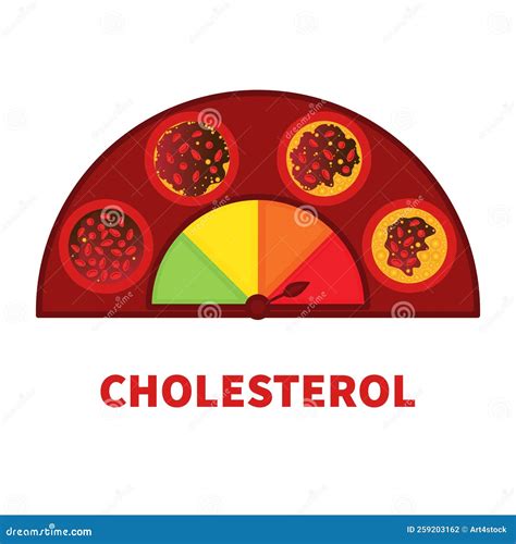 Cholesterol Level Meter Gauge with Blood Vessel Diagram Stock Vector ...