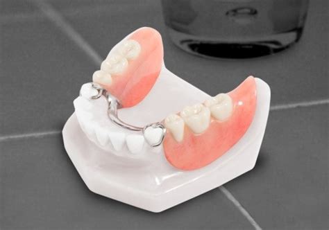 Partial Dentures – Dentista Clinic