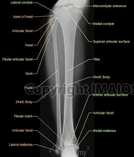 anatomy musculoskeletal x ray - Google Search | Medical radiography ...