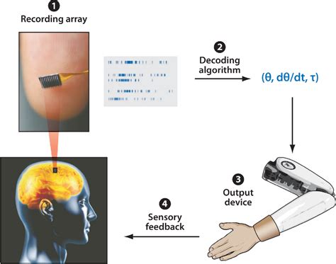 Figure 1 from The science of neural interface systems. | Semantic Scholar