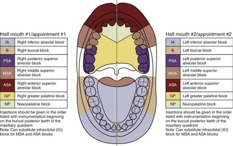 Dental Anesthesia Injection Sites