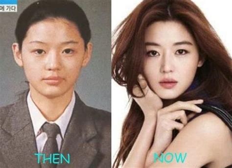 Korean Actors Before And After Plastic Surgery Korean Actors/actresses ...