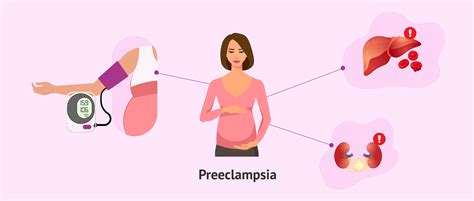 What is preeclampsia in pregnancy and why does it occur?