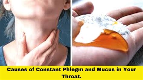 What Causes Excessive Phlegm In The Throat