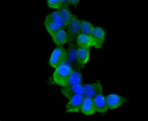 TIM-3 Antibody (MA5-32840)