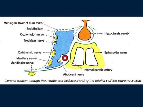 Cavernous sinus