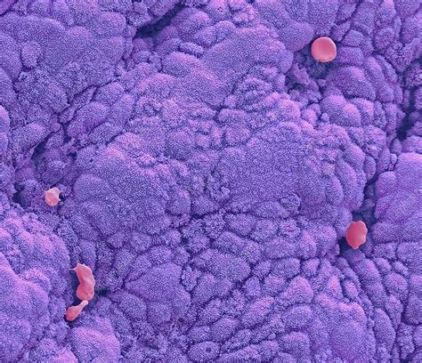 Uterus endometrium, SEM - Stock Image - C048/6299 - Science Photo Library