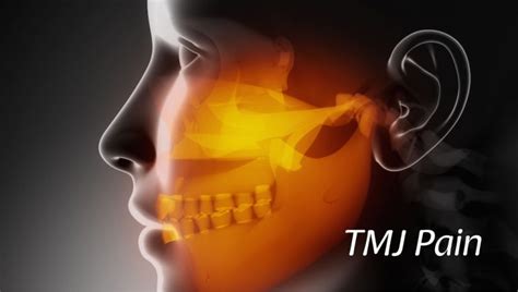 tmj-pain - Pacific Oral Surgery