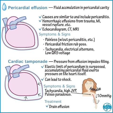 Don't forget - for a limited time, save 25% with code DRAWIT25 #pathology #usmle #pericardi ...