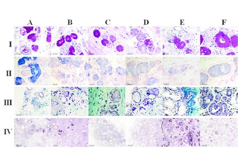 Histochemistry. Bronchial tissue stained with: I), PAS; II)... | Download Scientific Diagram