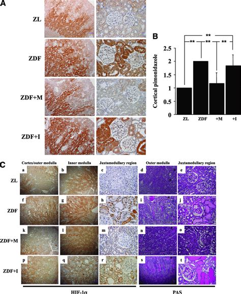 A: Immunohistochemistry for the hypoxia marker pimonidazole. Rats were ...