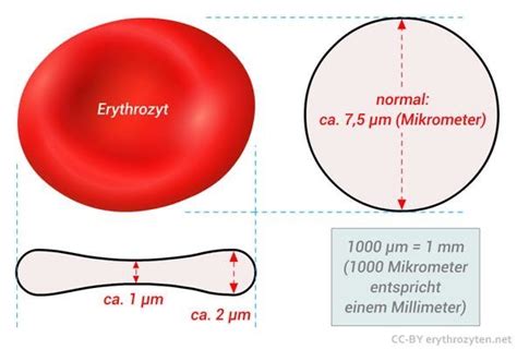 What is RDW in blood test? - Yoors