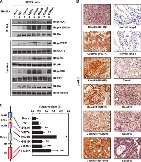 ALK mutations increased phosphorylation of ALK signaling pathways and... | Download Scientific ...