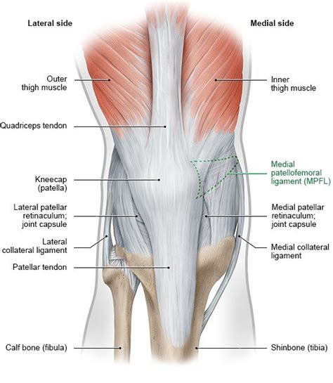 Dislocated kneecap: When is surgery recommended?