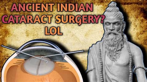 Worlds first cataract surgery | sushruta samhita | history of surgery in India in hindi - YouTube