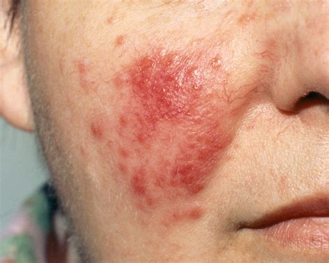 Skin Rash: 7 Causes of Red Spots and Bumps, With Pictures | Allure