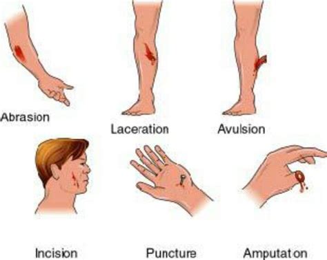 Human Body Diagrams For Wound Care