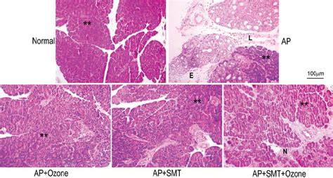 Representative images showing the histological changes in pancreatic ...