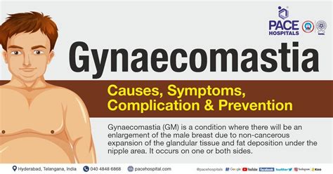 Gynecomastia – Symptoms, Causes, Complications and Prevention