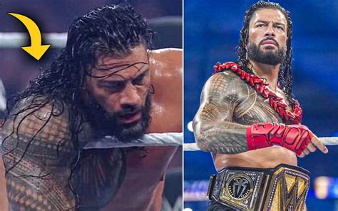 Roman Reigns injury: What injury did Roman Reigns suffer at SummerSlam ...