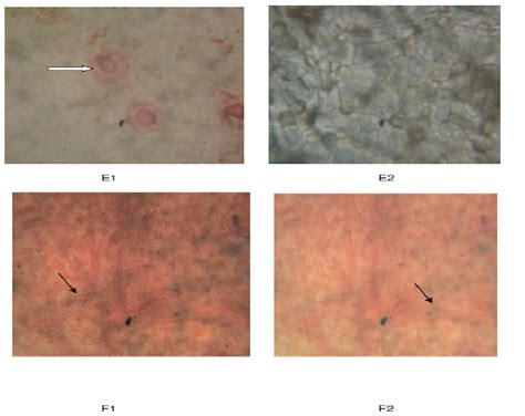 E1= Abaxial surface of (TLn21) showing anomocytic stomata and irregular ...