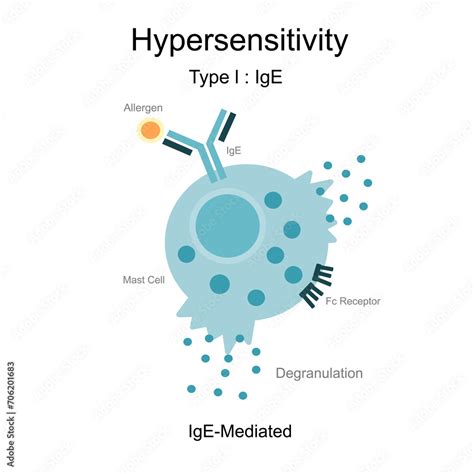 The diagram of Hypersensitivity type l : IgE (Immunoglobulin E ...