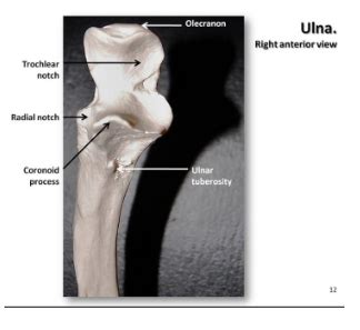 Sigmoid notch of olecranon process is found inA. Tibia-fibulaB. FemurC. Radius-ulnaD. Humerus