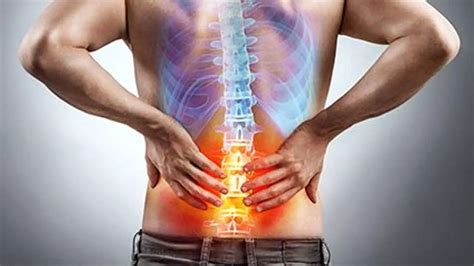 Spinal Fusion Complications Years Later - Long-term Effects of Spinal Fusion