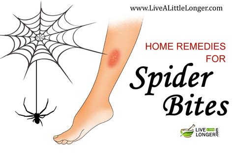 Natural Treatment For Spider Bites - Salt, Lemon And Potatoes