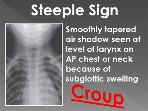 STEEPLE SIGN - Radiology Classroom