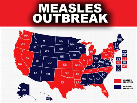 States With Measles Outbreak 2024 - Bertha Cherise