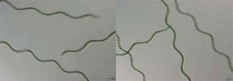 Microscopic view of Arthrospira platensis. | Download Scientific Diagram