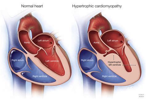 Some of the clinical causes for Sudden Cardiac Arrest (SCA) | Heartbeat of Champions Foundation