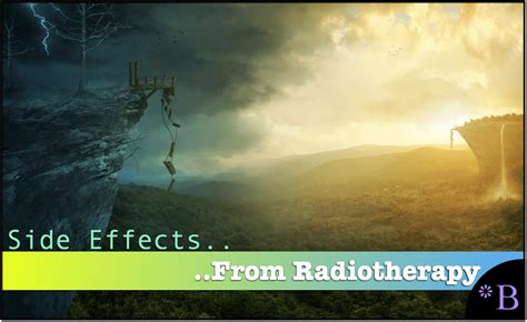 What Are the Side Effects of Radiotherapy? - Brightwork Research Treatment Database