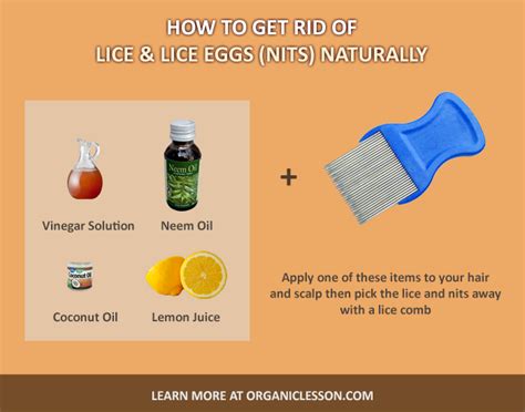 How to Get Rid of Head Lice and Eggs with Natural Home Remedies | Lice ...