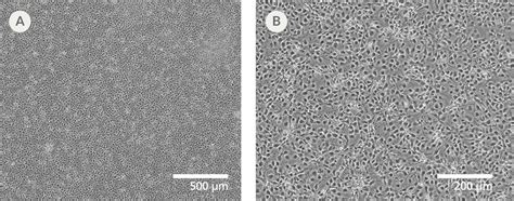 Neural Progenitor Cells, Human, Frozen | STEMCELL Technologies