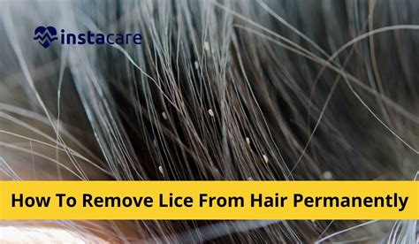 5 Effective Tips To Remove Lice From Hair Permanently At Home